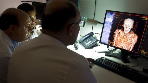 El equipo médico contempla la imagen de Nespamedu